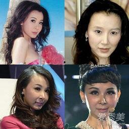 整残的女明星,探寻整残女明星的励志人生